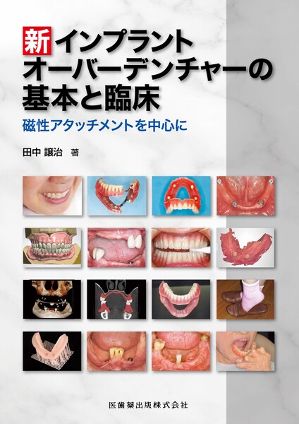 インプラントトラブルの対応策と予防策／医歯薬出版株式会社