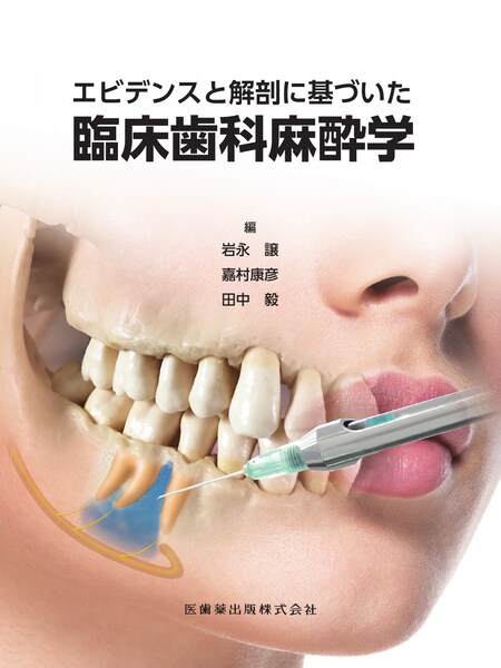非抜歯矯正治療 Molar Oriented Orthodonticsの実際／医歯薬出版株式会社