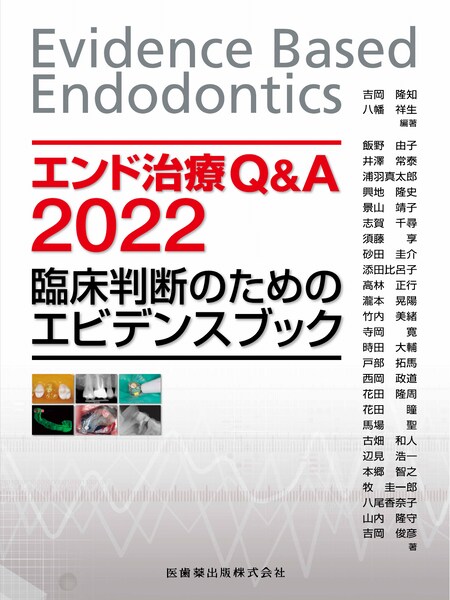 エンド治療Q&A2022 臨床判断のためのエビデンスブック／医歯薬出版株式会社