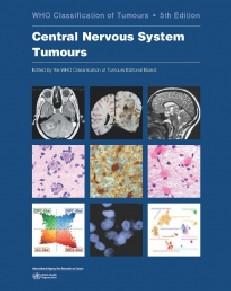 洋書 Breast Tumours , WHO 5th edition IARC Publications Website