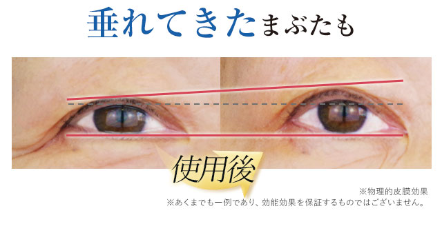 公式】『リッドキララ』まぶたには、まぶたの最終手段