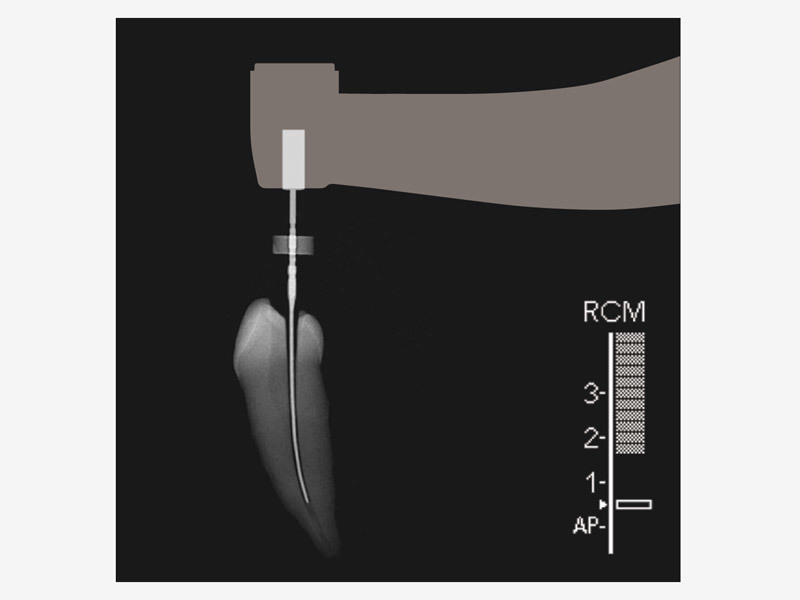 Tri Auto ZX2 | MORITA