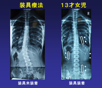 側弯症外来 | 診療科目一覧 | 大田区蒲田 牧田総合病院 | 社会医療法人