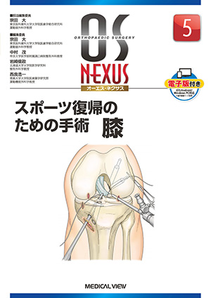 メジカルビュー社｜整形外科｜OS NEXUS 15 膝関節手術の落とし穴
