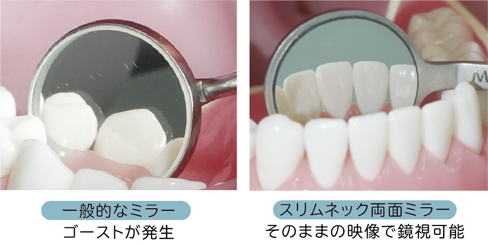 歯鏡| スリムネック両面ミラー（3P／4P） | 名南歯科貿易株式会社