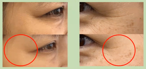 MAJOR | 2025年 マジョール タイムレスリペアクリーム 50g