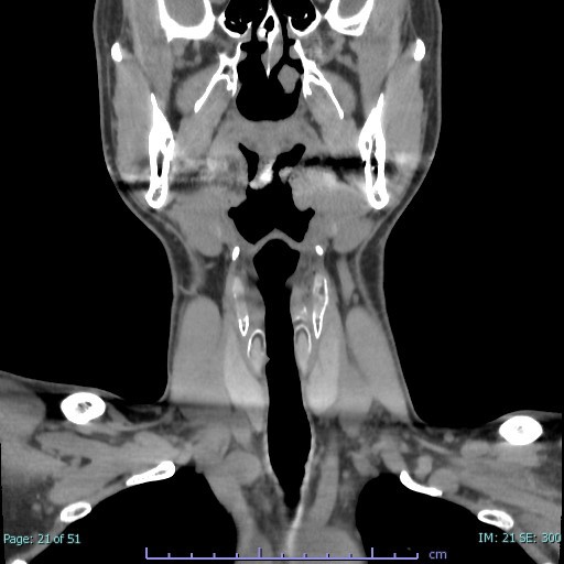 頭頸部のファーストチョイス｜MRI・CTのファーストチョイス｜医師の方