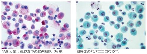 臨床検査用染色液・試薬及び顕微鏡用グラス、替刃等に貢献する武藤化学