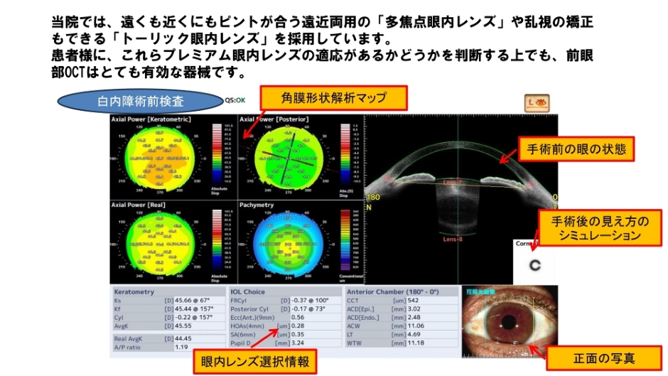検査内容と目的｜のみやま眼科｜北見市常盤町の眼科｜白内障