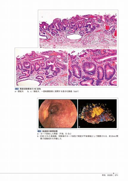 癌診療指針のための病理診断プラクティス | 株式会社中山書店