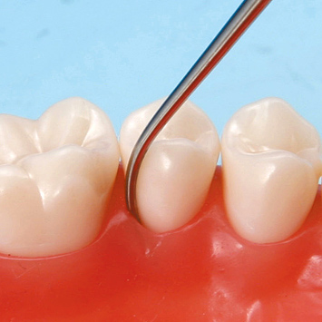 SRP用顎模型 [D16D-500H(GSF)-MF](D咬合器つき)｜株式会社ニッシン