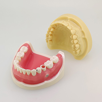 模型歯セット(7部位) [AB1-X.1635(7S)]｜株式会社ニッシン｜歯科模型