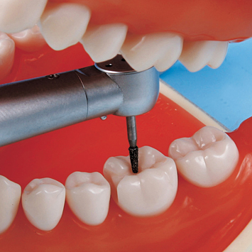 保存修復実習用顎模型 [D18FE-500E(GUB)](FE咬合器つき)｜株式会社