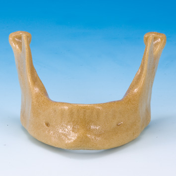 ドリリング実習用顎模型 [E7-X.1136]｜株式会社ニッシン｜歯科模型