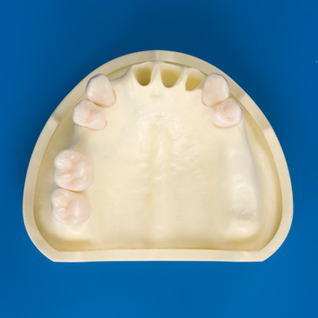 グラフト実習用顎模型 [P9-X.876]｜株式会社ニッシン｜歯科模型・歯科