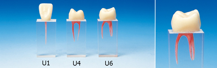 歯冠付き歯内療法実習用ブロック [S3シリーズ]｜株式会社ニッシン