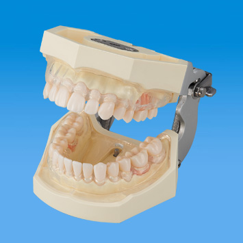 スケーリング・ルートプレーニング領域｜株式会社ニッシン｜歯科模型