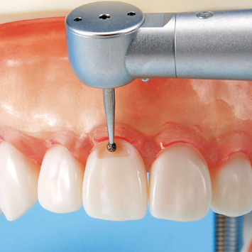 保存修復実習用顎模型 [D16D-500E(GSE)](D咬合器つき)｜株式会社