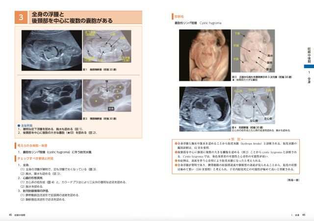 所見から探る 産科 超音波診断｜株式会社総合医学社