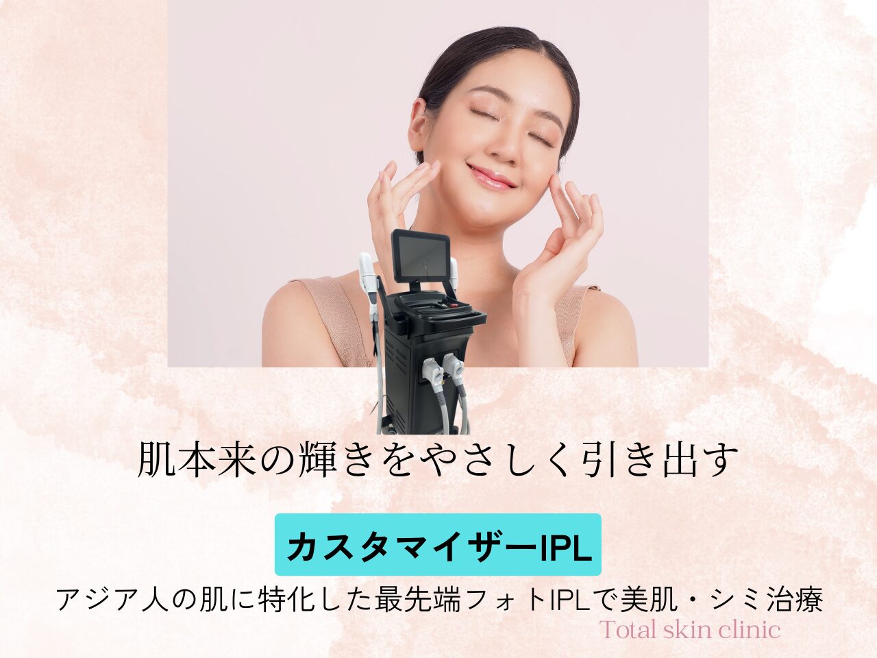 カスタマイザーIPL,フォトIPL,シミ,くすみ,赤み｜福岡・天神・大名の