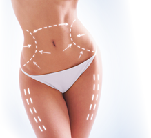 ライポソニックス（Liposonix）| ボディ・医療痩身｜北九州の美容外科