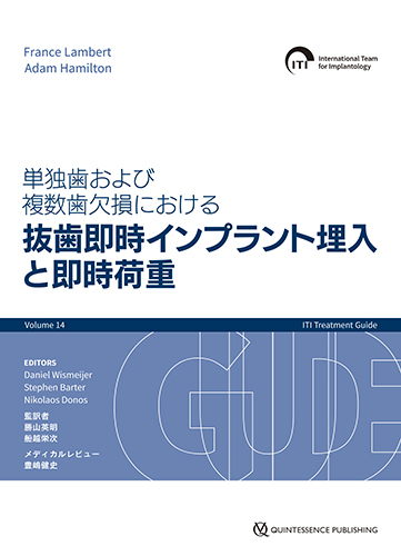単独歯および複数歯欠損における抜歯即時インプラント埋入と即時荷重