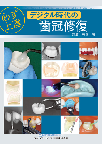 必ず上達 デジタル時代の歯冠修復 | 【歯科学】新刊書籍&おすすめ書籍