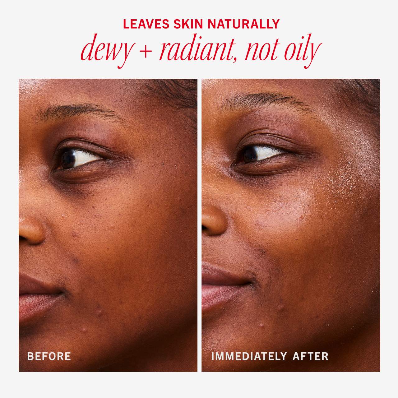 Hydrating Dewy Gel Cream Moisturizer with Hyaluronic Acid +