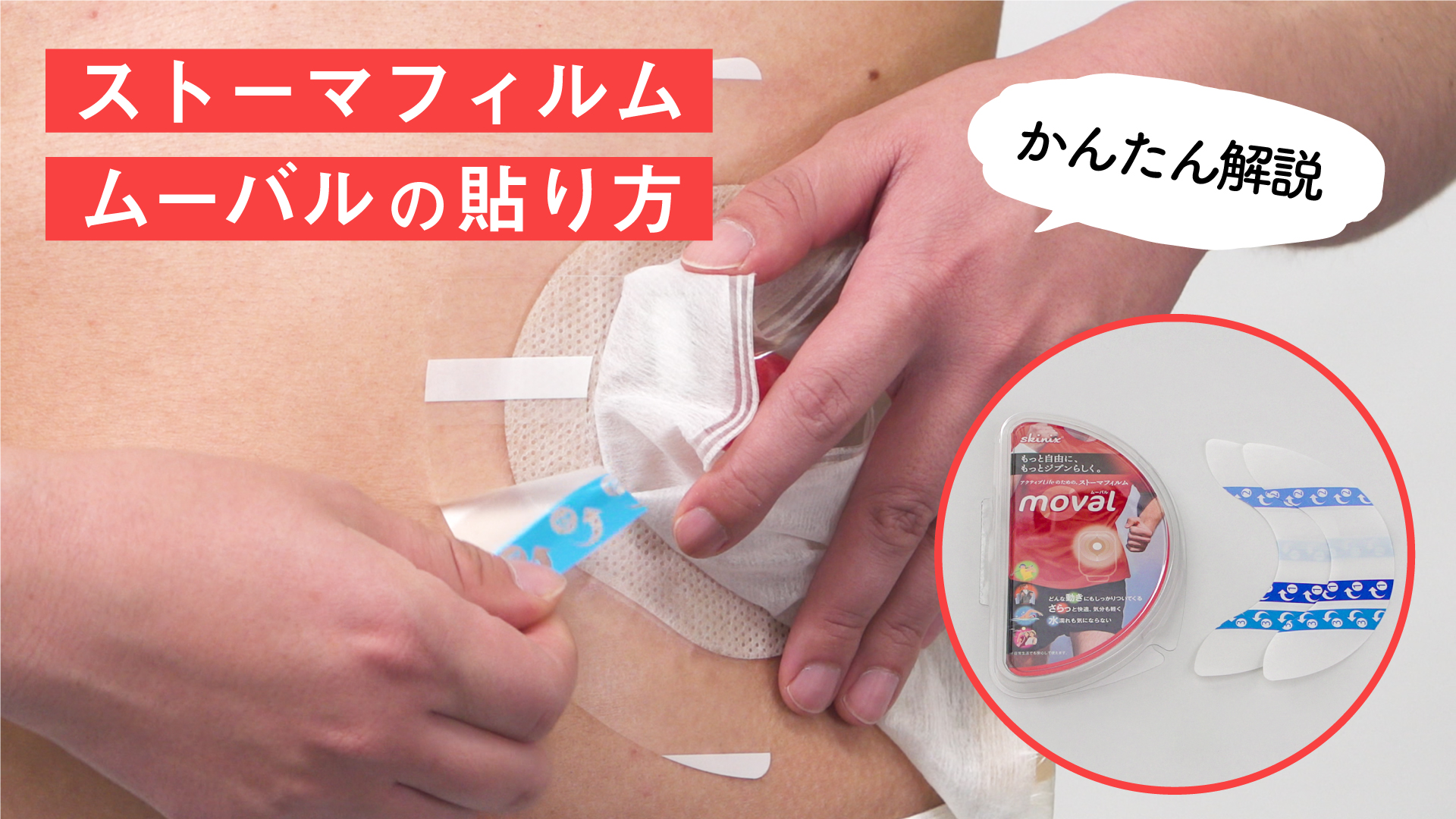 ストーマ装具の漏れ予防」としてストーマ保護フィルム「moval(ムーバル