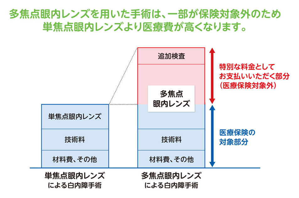多焦点眼内レンズ - 鈴木眼科クリニック名東 - 名古屋市名東区の眼科
