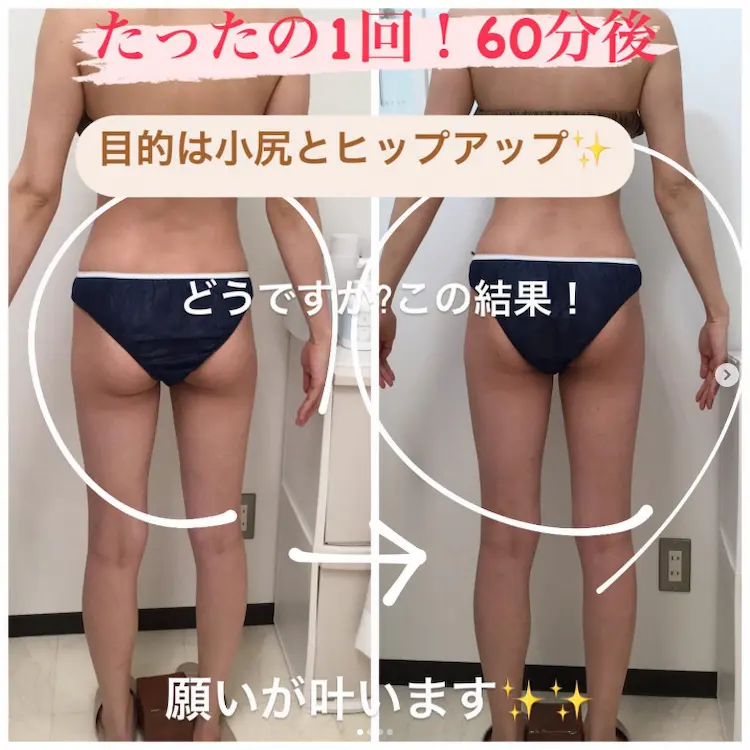 水戸エステ】世界が愛する『エンダモロジー』で、心地よく理想のボディ