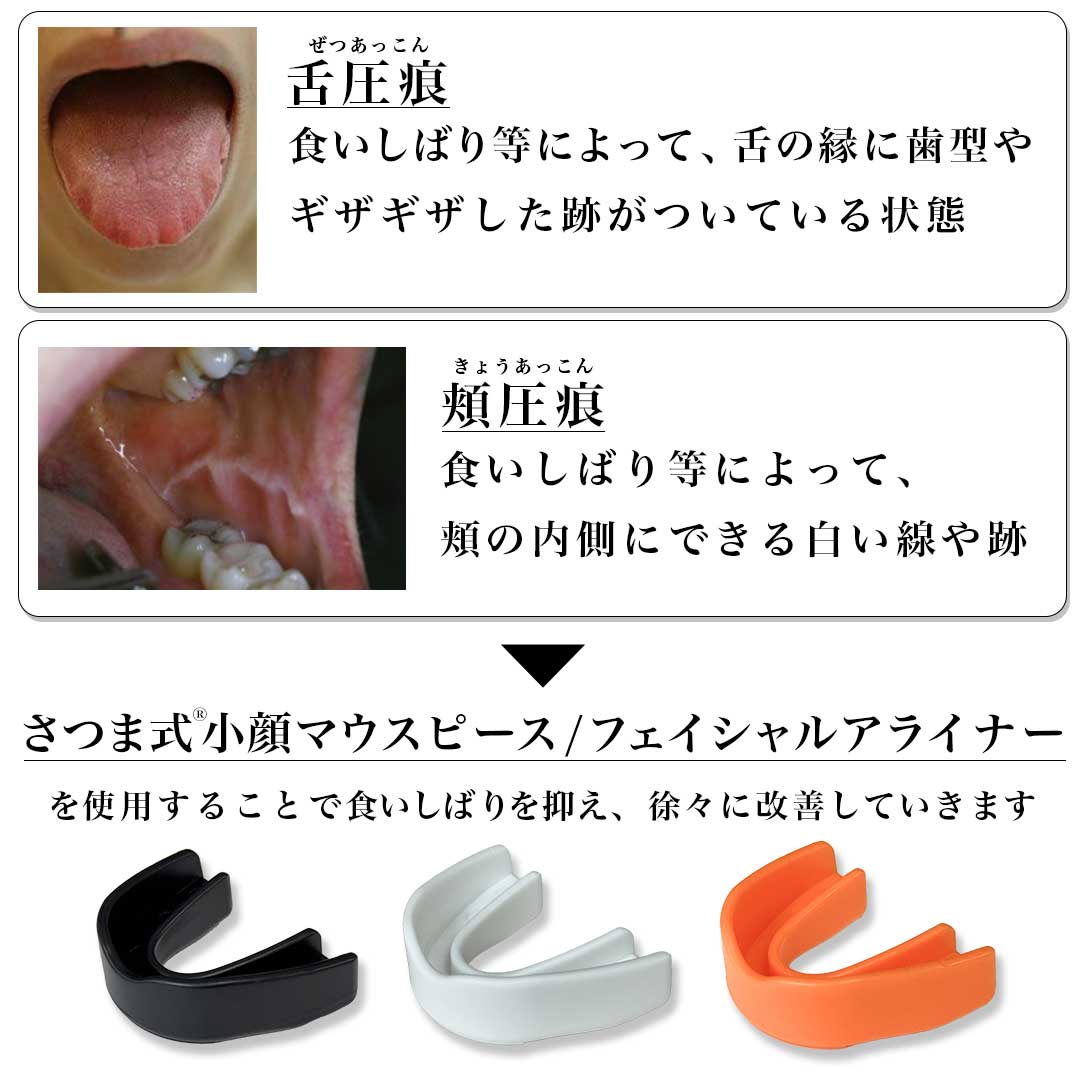 さつま式小顔マウスピース Facial Aligners【各種単品】 - SUGARCRANZ
