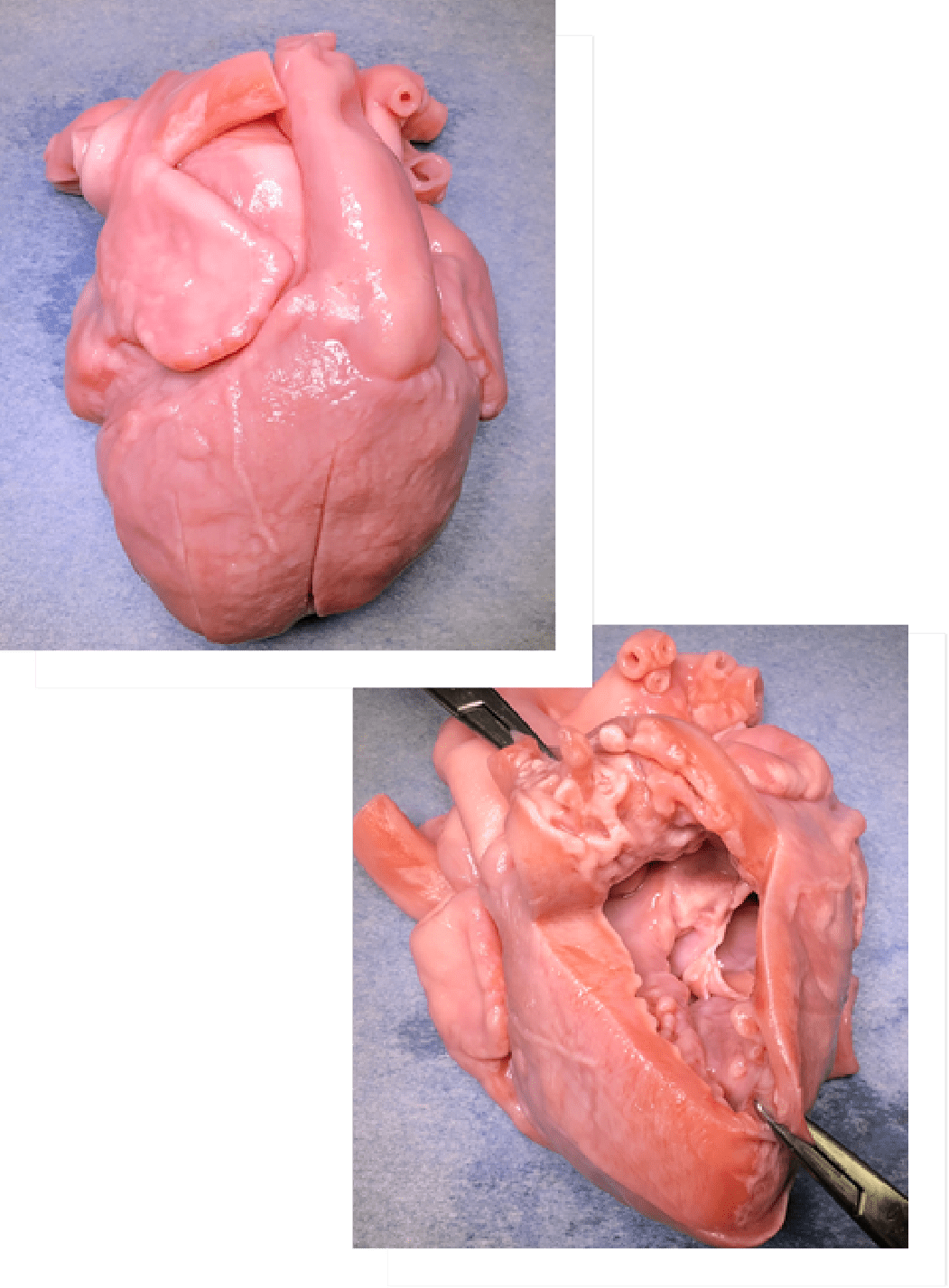 研究内容 | ped UT-Heart研究室