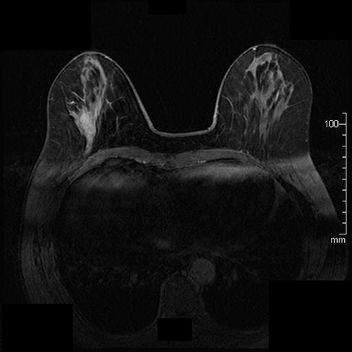 MRI装置｜徳島赤十字病院