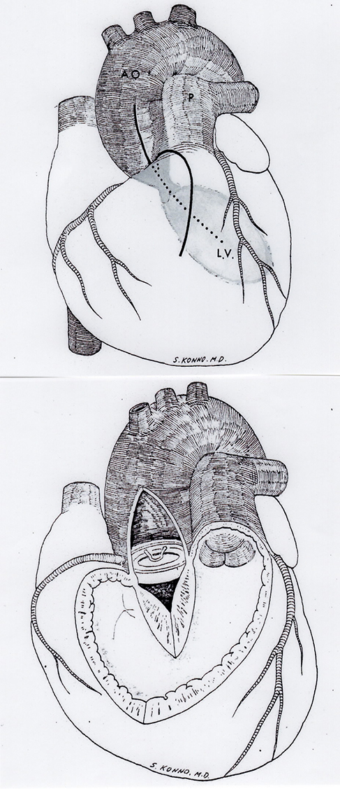 心臓外科の父と天才外科医 榊原仟と今野草二】文京区,内科,本郷,循環器