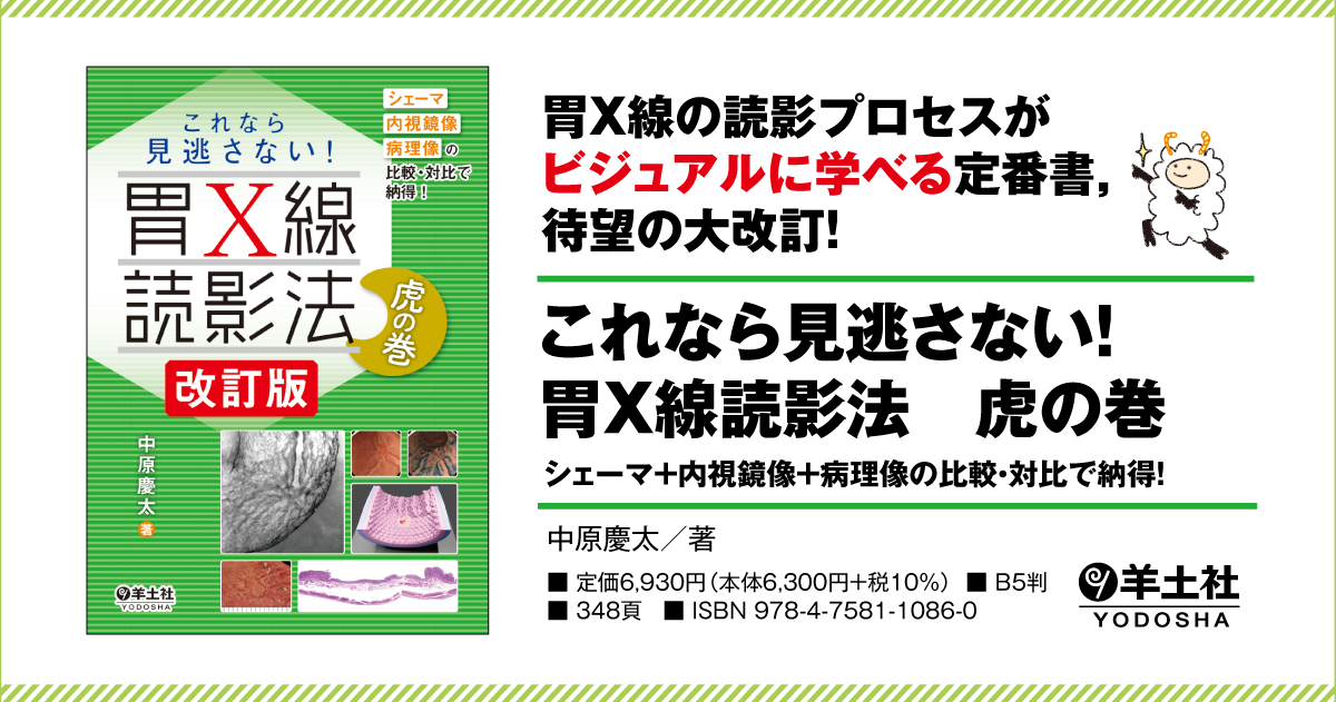 これなら見逃さない！胃X線読影法 虎の巻 改訂版〜シェーマ＋内視鏡像