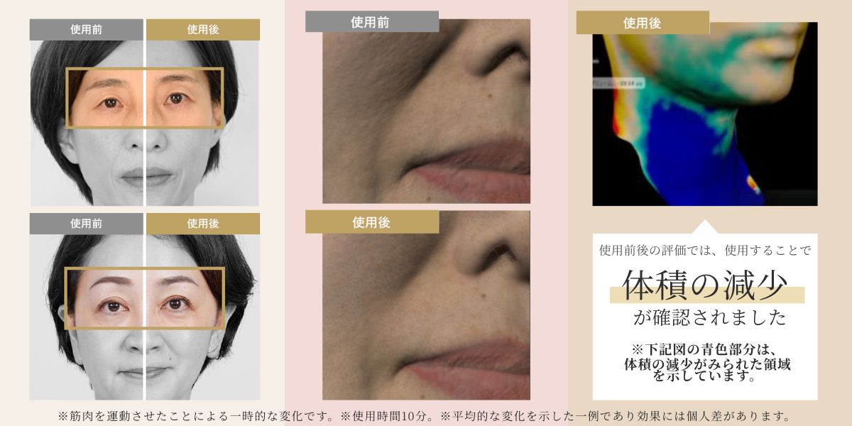 ヤーマン公式通販サイト | ヤーマンオンラインストア