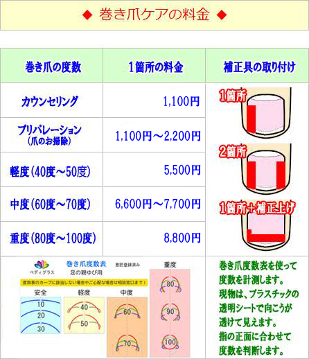 巻き爪ペディグラステクノロジー | 靴のやまごん | 靴のやまごん