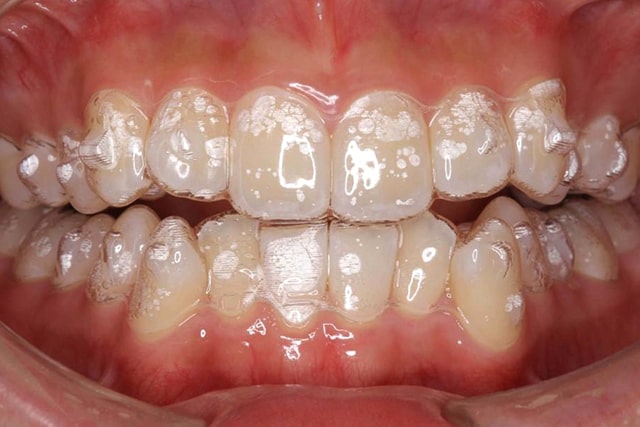 矯正歯科治療 | 横浜桜木町歯科