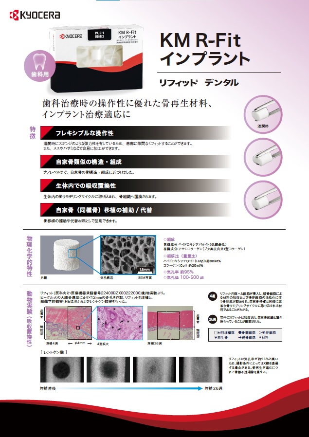 京セラ KM R-Fit インプラント リフィット デンタル ｜ ヨシダタロウ