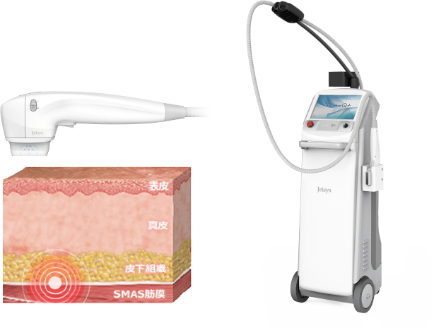 HIFU ハイフ（ウルトラセルQプラス） - 天満橋ゆみ皮膚科｜一般皮膚科