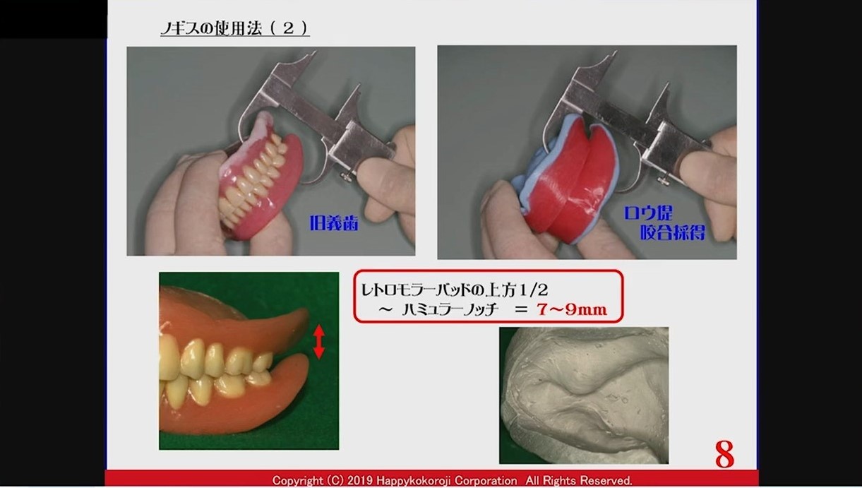 人気動画】今さら聞けない総義歯治療の基本/澤田宏二先生 | Doctorbook