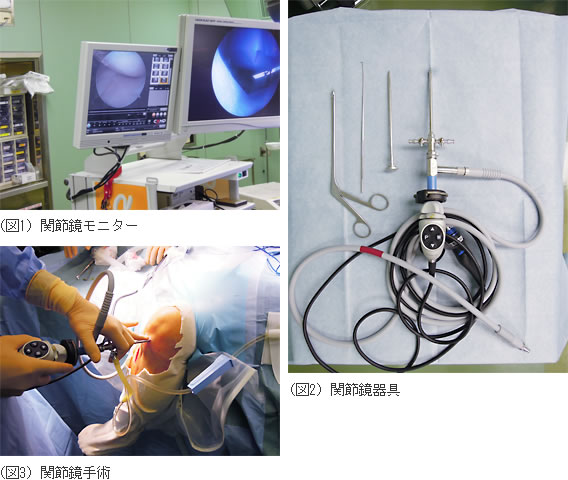主な病気・治療について｜整形外科
