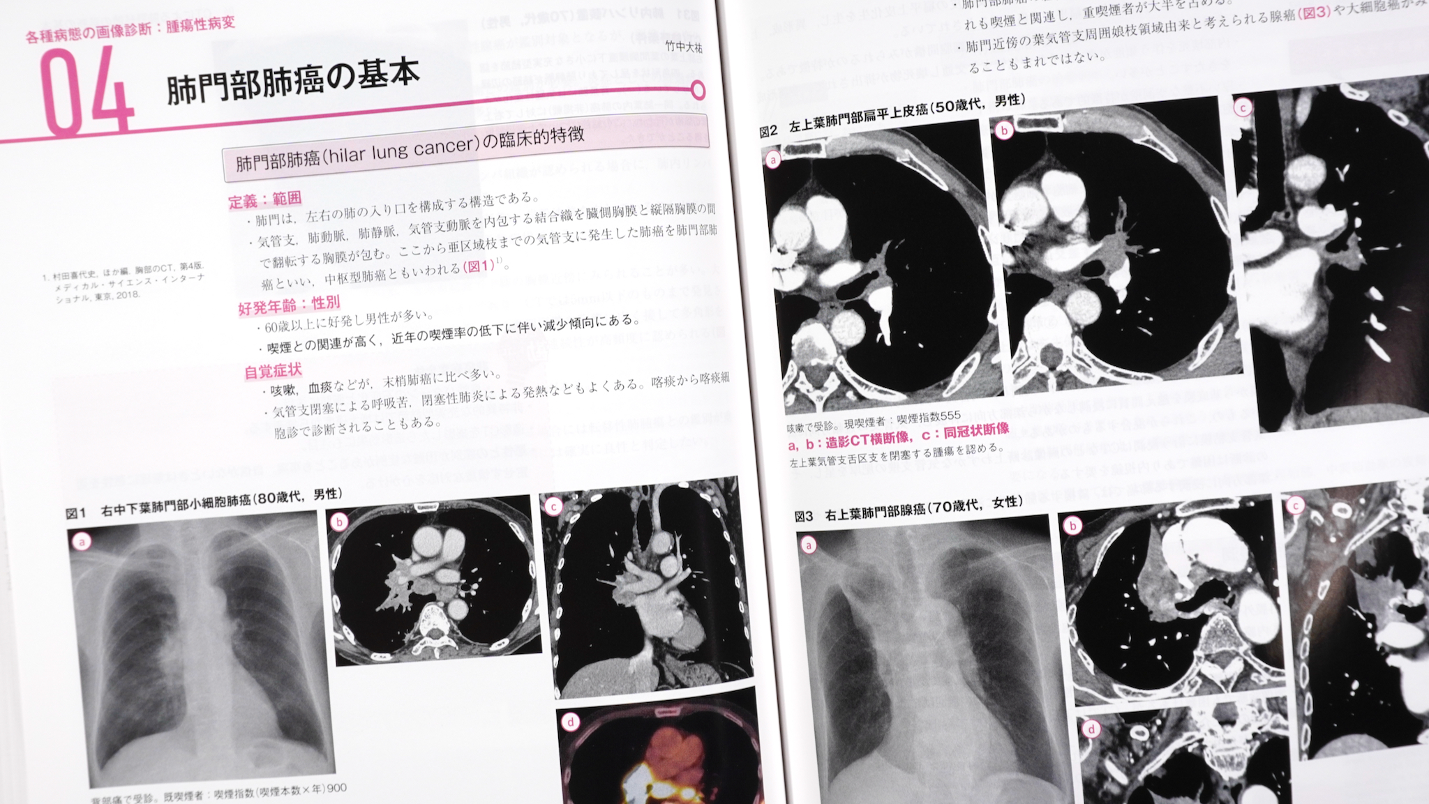 胸部 画像診断の勘ドコロNEO / Anatomy 今日も明日も/胸部 画像診断の