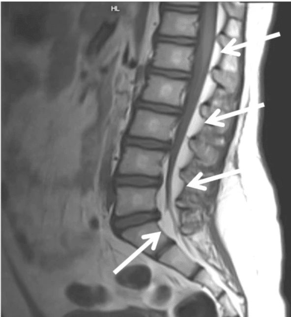 50章 腰の痛み Low Back Pain｜KEN