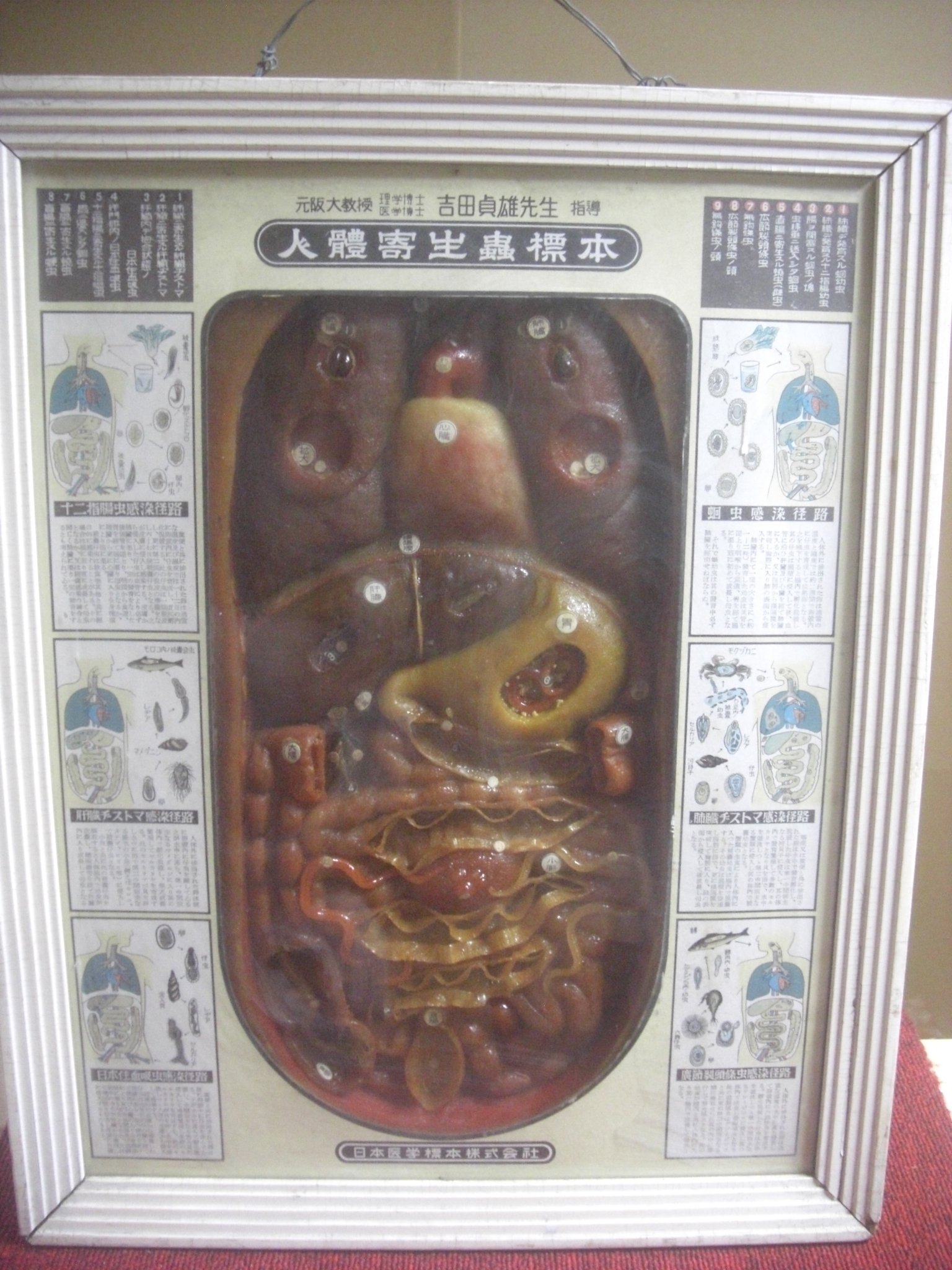 レトロ 教材 人体寄生虫標本 元阪大教授 栃洞中学校 神岡 ジャンク扱い