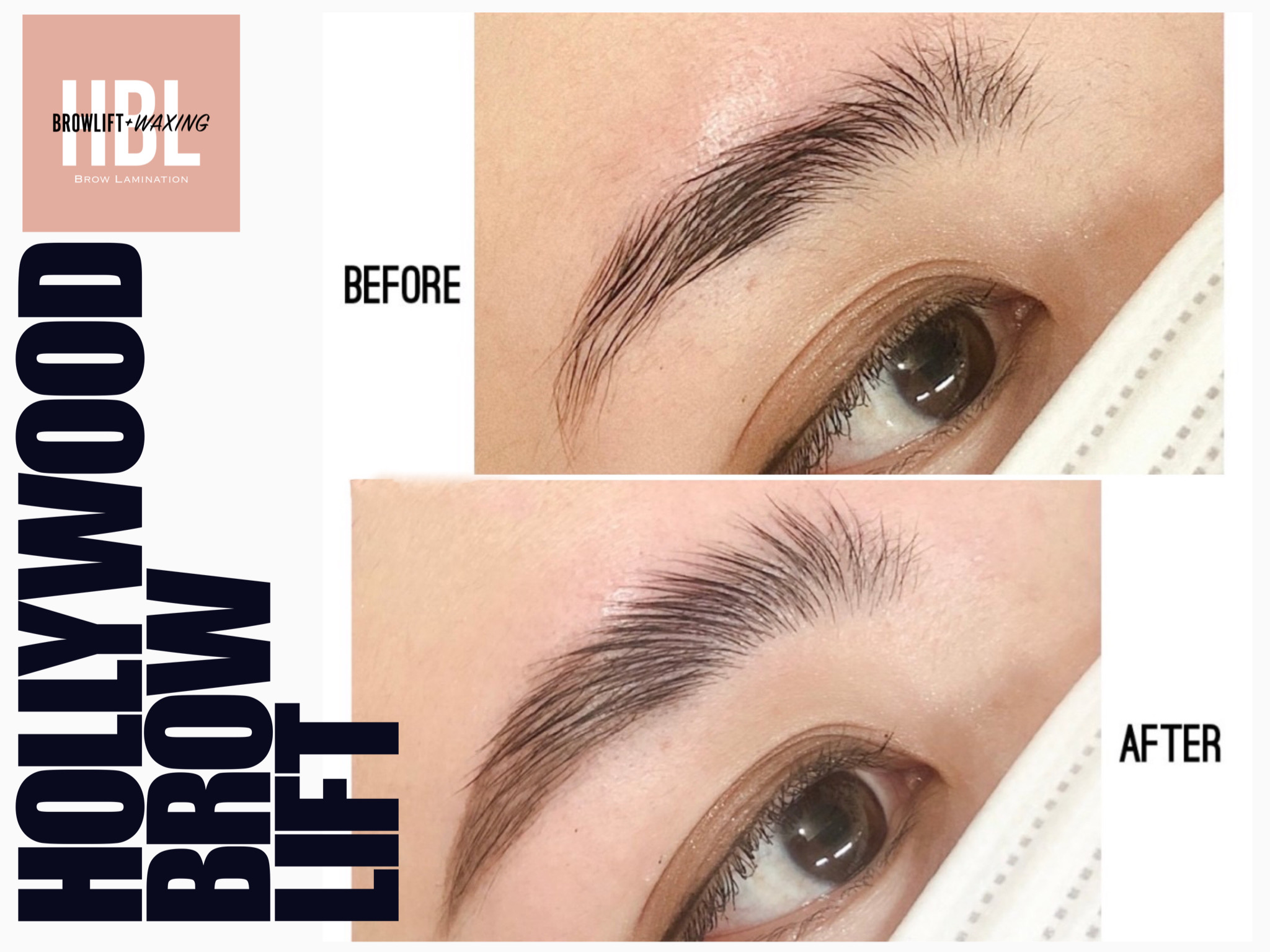 ハリウッドブロウリフトって何？効果やワックス脱毛との違いを徹底解説