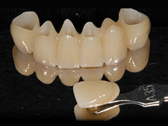 ジルコニア製品（フルジルコニア／ジルコニアボンドクラウン）｜歯科