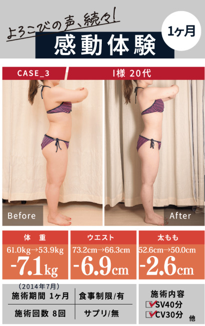 都度払いOK】大阪で痩身エステの体験が安いおすすめサロン9選 | Beauty