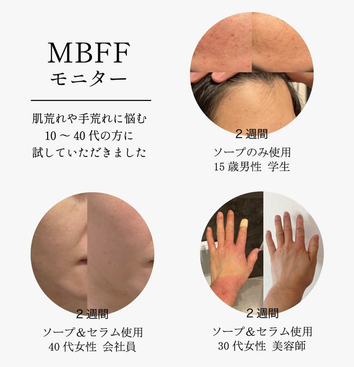 MBFFマムフローラセラムPro 30ml – DD